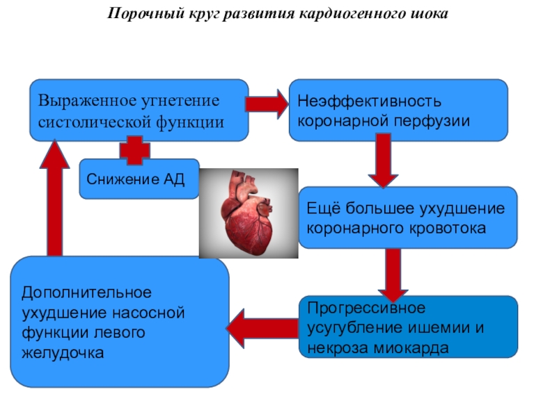 Схема патогенеза кардиогенного шока