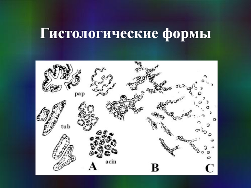 Гистологические формы рака. Гистологические формы.