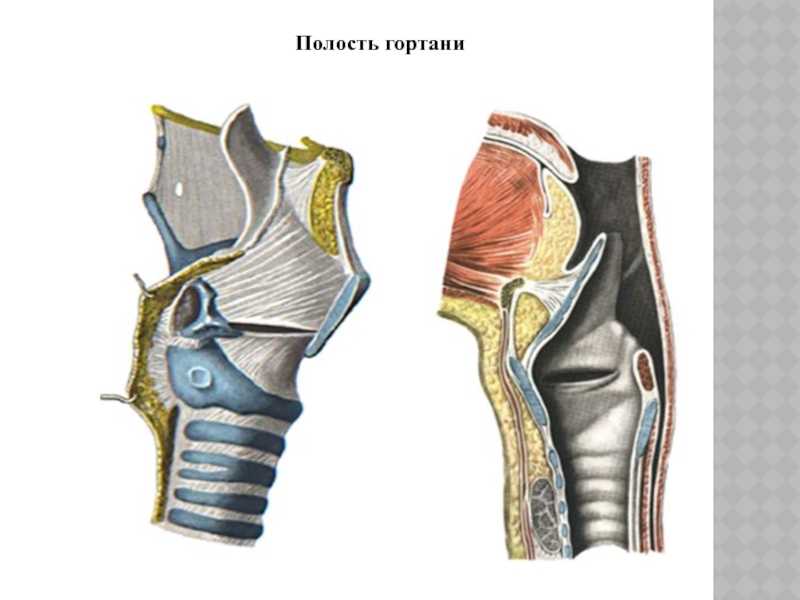 Преддверие гортани ограничено. Гортань в продольном разрезе. Складка преддверия гортани.