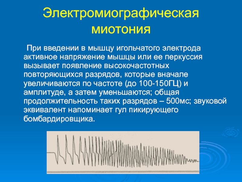 Миотония это