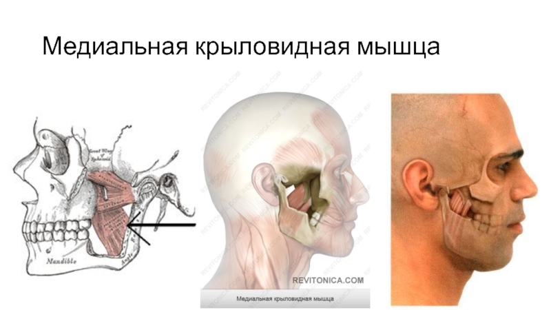 Крыловидная мышца челюсти фото