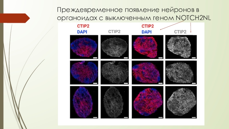 Ли активность. Продолжительность жизни клетки нервная. Продолжительность нейронов. Срок жизни нейронов. Продолжительность жизни нейронов.