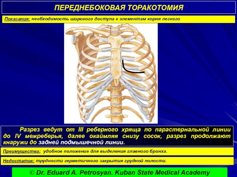 Реферат: Операции на грудной стенке и органах грудной полости