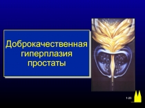BPH.ppt