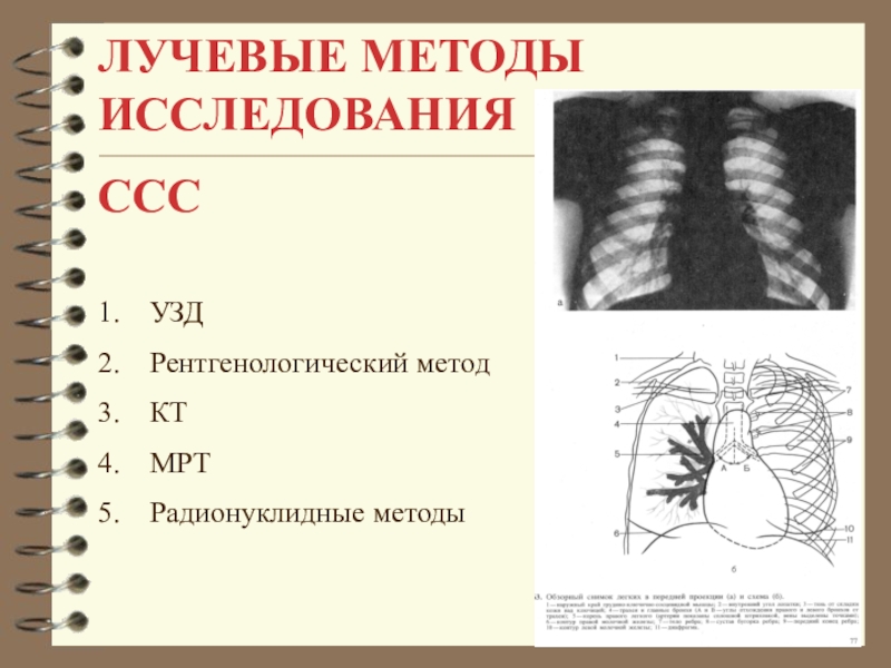 Лучевая диагностика сердечно сосудистой системы презентация