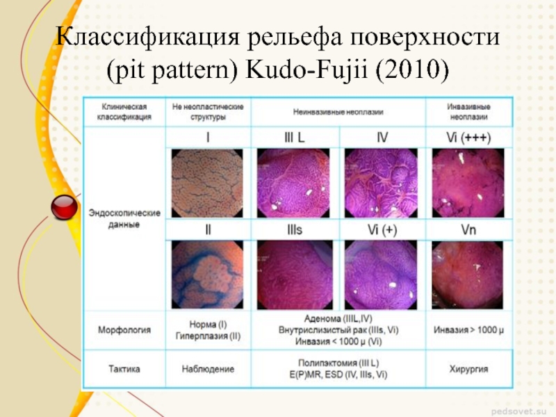 Ямочный рисунок по кимура