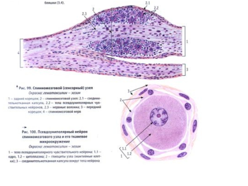 Спинномозговой узел гистология рисунок