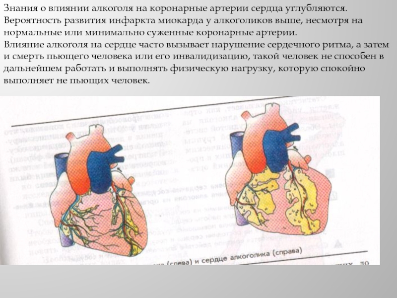 Влияние знания. Влияние алкоголя на сердце. Алкоголь влияет на сердце. Вредное воздействие алкоголя на сердце. Влияние алкоголя на сердце и кровеносные сосуды.