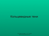 Кольцевидные тени