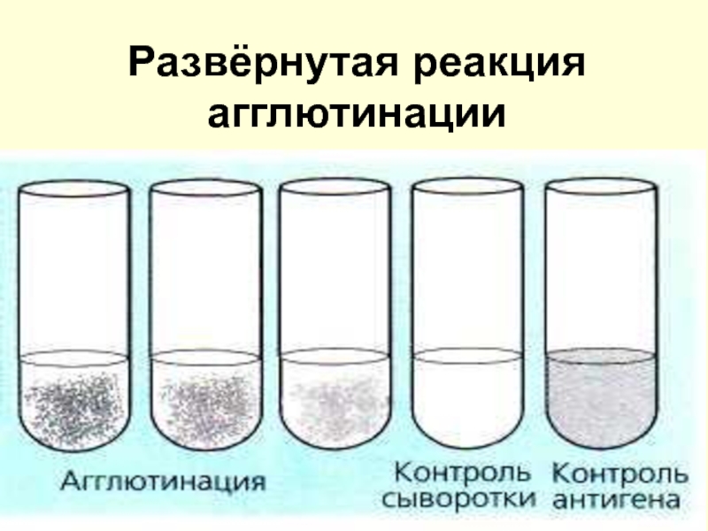 Реакция агглютинации микробиология схема