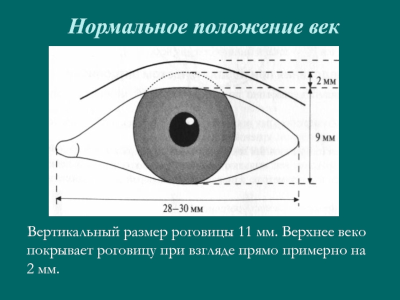 Положение век. Нормальное положение век. Диаметр роговицы в норме.