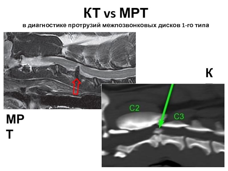 Кт в неврологии презентация