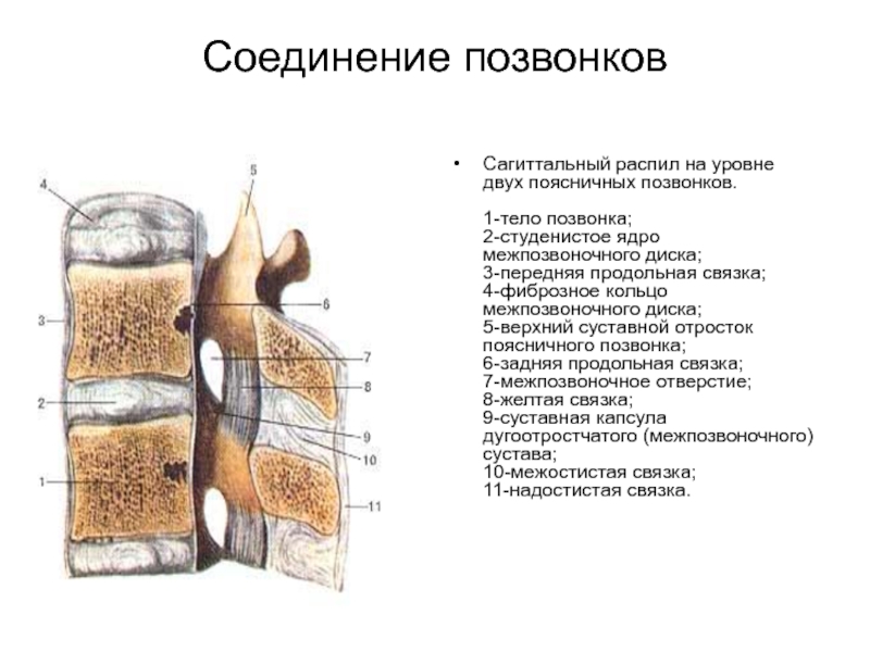 Соединения позвонков. Соединения позвонков Сагиттальный распил. Сагиттальный разрез позвоночника. Соединение позвонков животных. Студенистое ядро межпозвоночного диска.