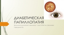 ДИАБЕТИЧЕСКАЯ ПАПИЛЛОПАТИЯ