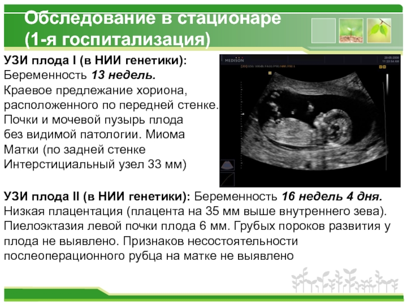 Шевеления на 12 неделе. Краевое расположение хориона на 12 неделе беременности. Низкая плацентация при беременности 13 недель. Предлежание хориона на 12 неделе. Краевоепредлежание хориони..