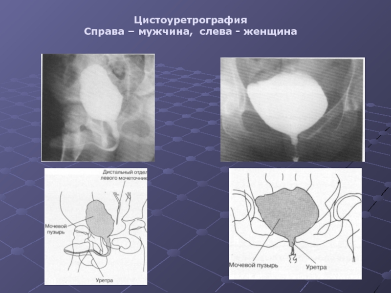 Лучевая диагностика заболеваний почек презентация