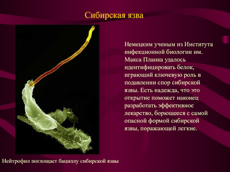 Сибирская язва презентация инфекционные болезни