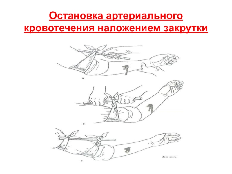 Первая медицинская помощь при травматическом шоке презентация