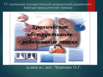 ГУ Луганский государственный медицинский университет
Кафедра факультетской