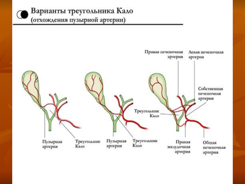 Холецистит книги. Холецистит хирургия презентация. Острый холецистит презентация. Острый холецистит хирургия. Острый холецистит диаграмма.