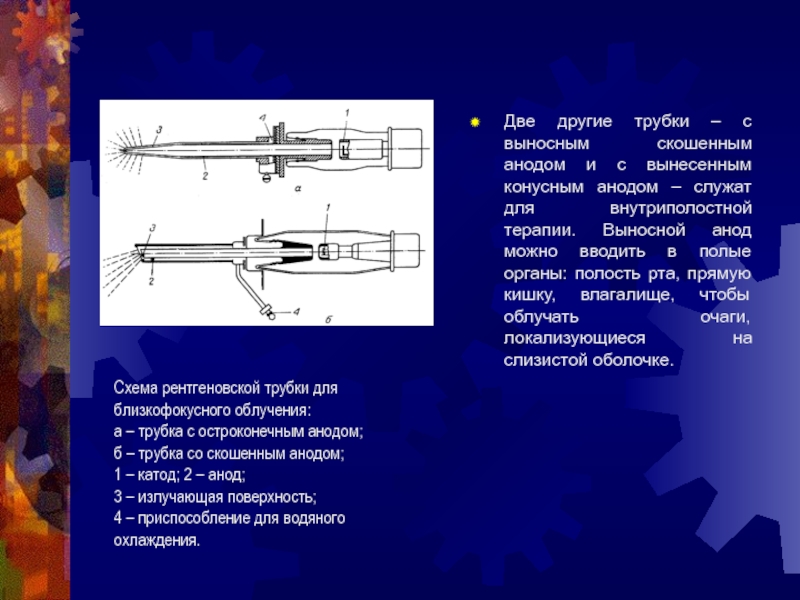 Техническое обеспечение лучевой терапии презентация