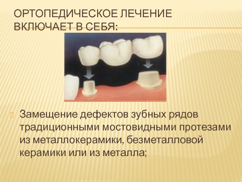 Обследование пациентов с обширными дефектами зубных рядов презентация