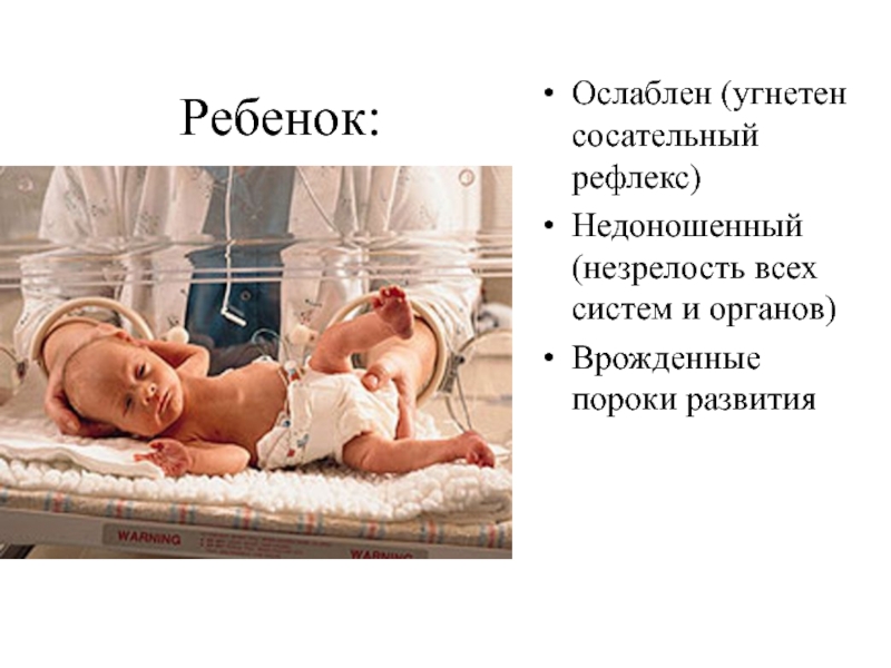Сосательный рефлекс у детей. Сосательный рефлекс у недоношенных. Рефлексы у недоношенных новорожденных. Рефлексы недоношенного новорожденного ребенка.