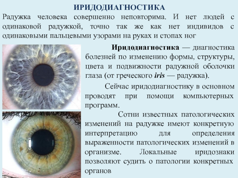 Как по глазам определить болезнь картинки