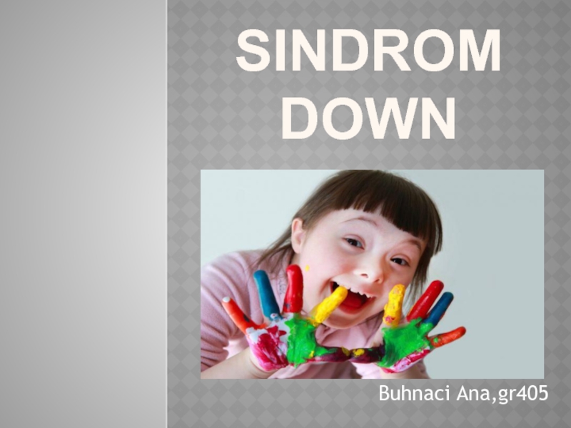 Презентация Sindrom Down