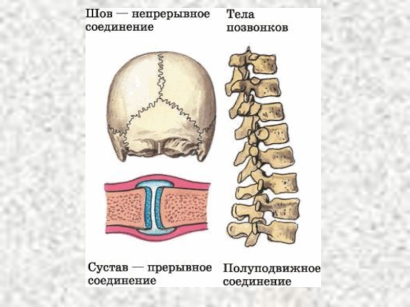 Прерывное соединение кости. Типы соединения костей полуподвижные. Непрерывные соединения костей. Непрерывный Тип соединения костей. Прерывный Тип соединения костей.