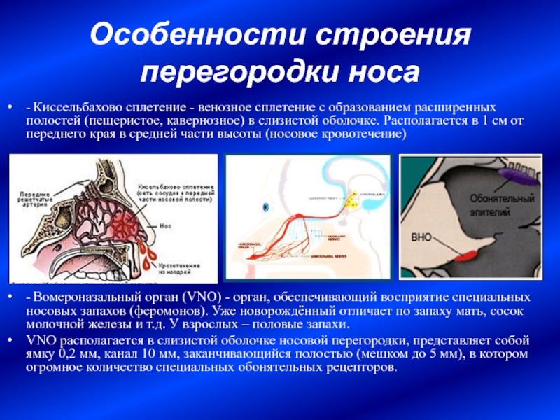 Расширенная полость. Носовые кровотечения зона Киссельбаха. Сплетение Киссельбаха кровотечение. Киссельбахово сплетение расположено. Носовая перегородка строение.