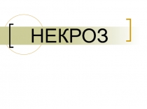 Некроз