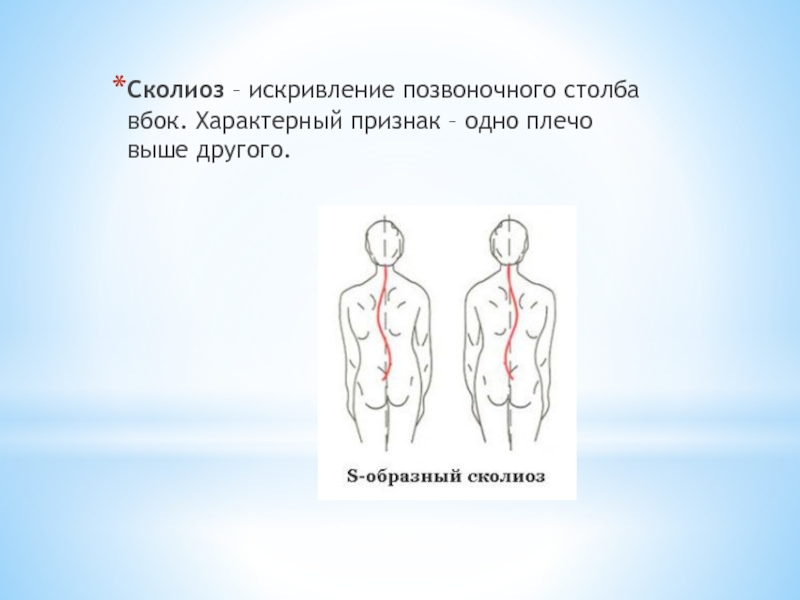 Правое плечо выше другого. Одно плечо выше другого сколиоз. Плечо выше другого. Одно плечо выше другого.