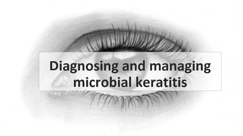 Презентация Diagnosing and managing microbial keratitis