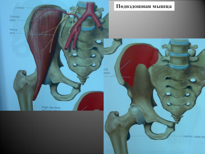 Подвздошная мышца анатомия