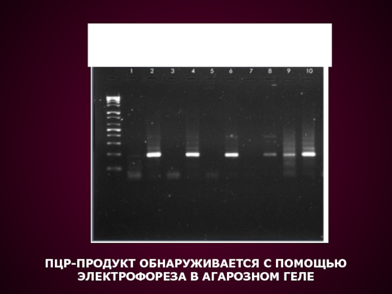 Тест песня электрофорез