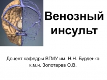 Венозный инсульт