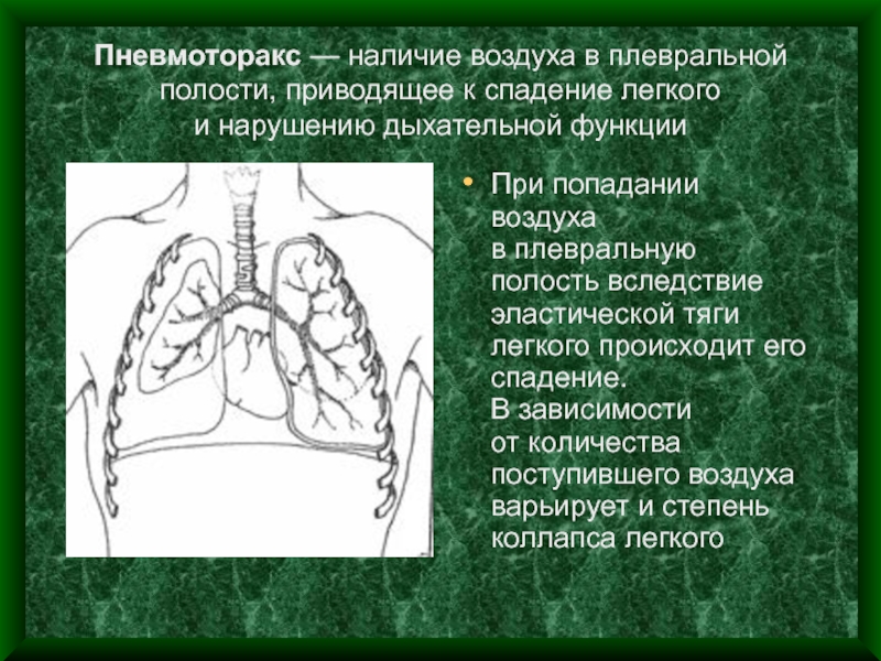 Полость привести. Осложнения клапанного пневмоторакса. Ненапряженный пневмоторакс. Закрытый напряженный пневмоторакс. Анатомическое обоснование пневмоторакса.