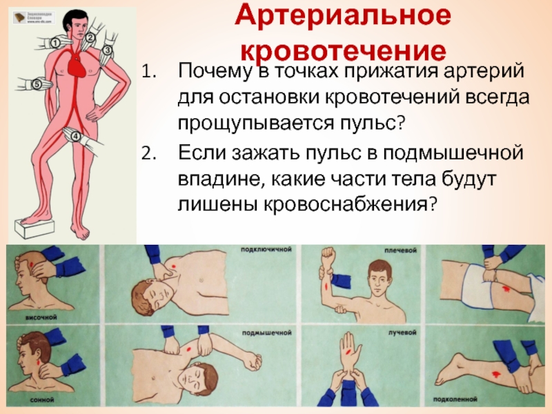 Для временной остановки артериального кровотечения необходимо выполнить. Точки прижатия артерий для остановки артериального кровотечения. Точки прижатия для остановки кровотечения. Места прижатия артерий для остановки кровотечения. Артериальное кровотечение точки прижатия артерии.