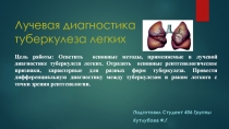 Лучевая диагностика туберкулеза легких