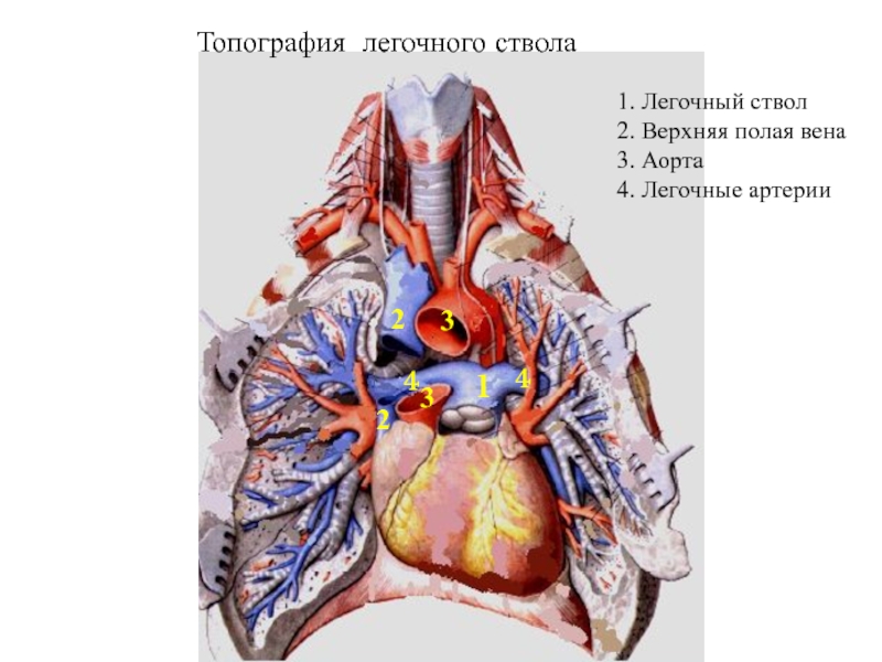 Полая легочная вена. Верхняя полая Вена топография. Топография легочного ствола и легочных артерий. Легочный ствол и легочная Вена. Топографическая анатомия легочного ствола.