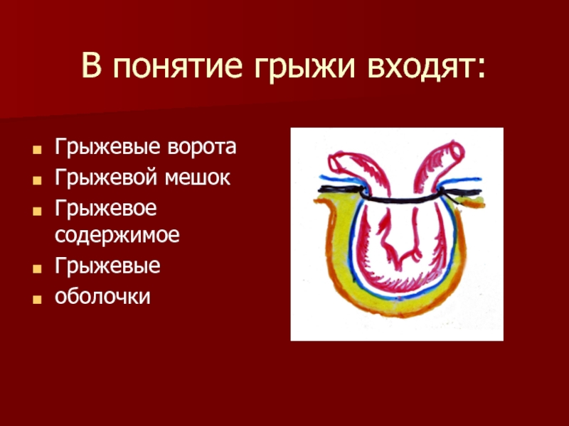 Осложнения грыж. Оболочки грыжевого мешка. Осложнения грыж презентация.