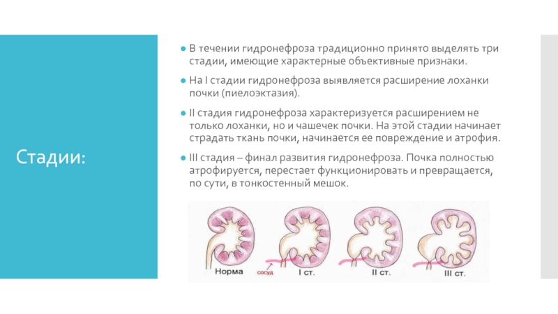 Каши при гидронефрозе