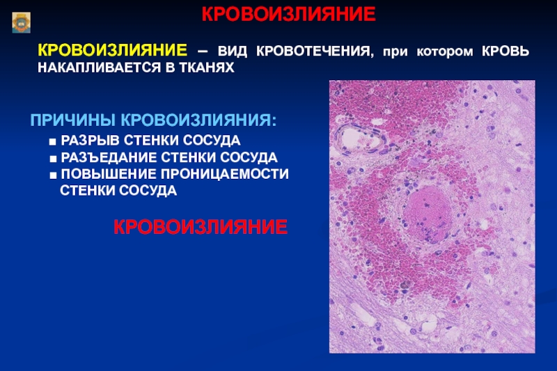 Клиническая картина при кровотечениях