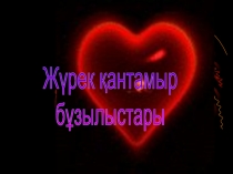 Жүрек қантамыр
бұзылыстары