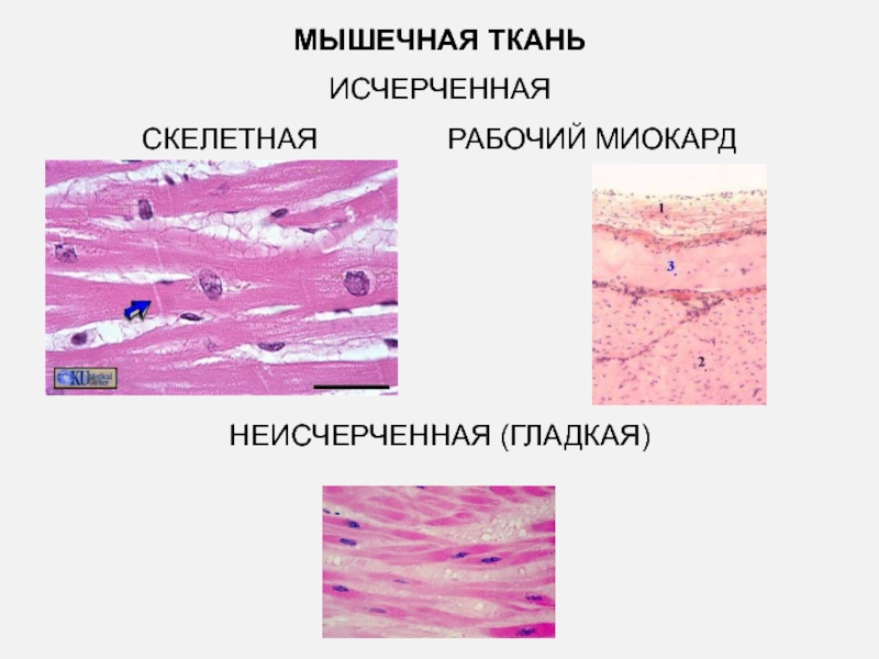 Картинка гладкой мышечной ткани