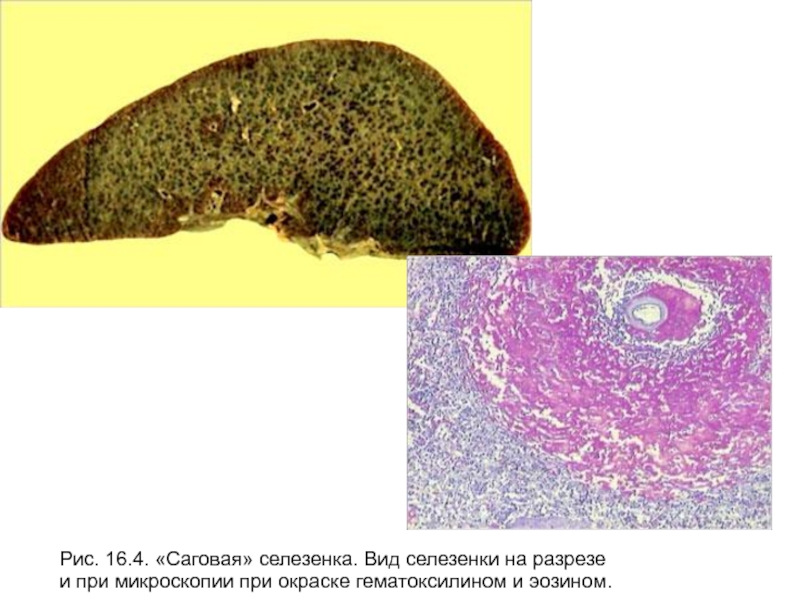 Саговая селезенка микропрепарат рисунок