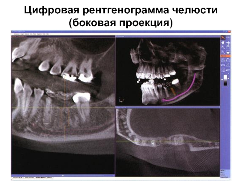 Реферат: Цифровая рентгенография