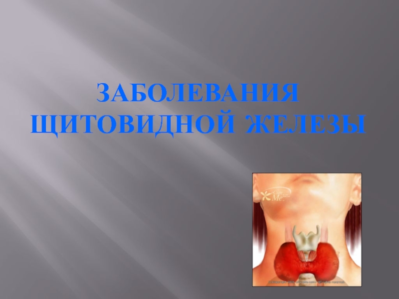 Презентация Заболевания щитовидной железы 