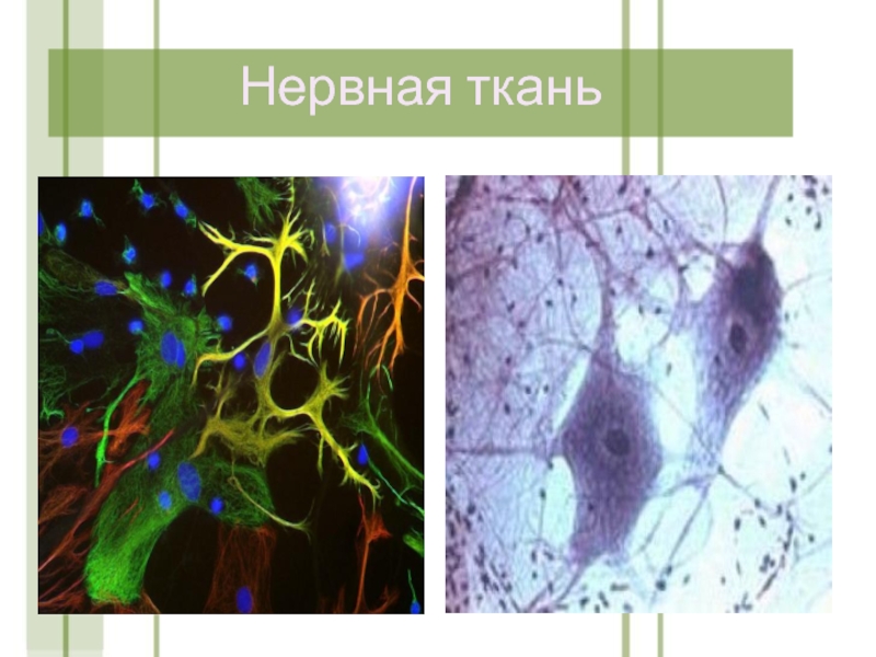 Нервная ткань рниму презентация